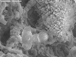 Large wooly spheroids near wooly aggregate by D. Northup