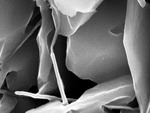 Close view of interlocking needles in microspar
