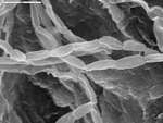 Close up of segmented filament with dimples